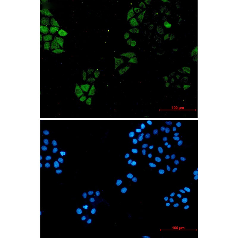 S100A4 Antibody