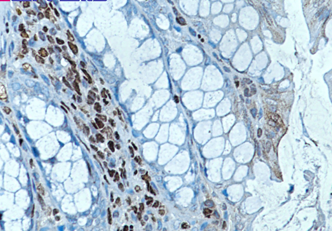 RUNX Rabbit mAb