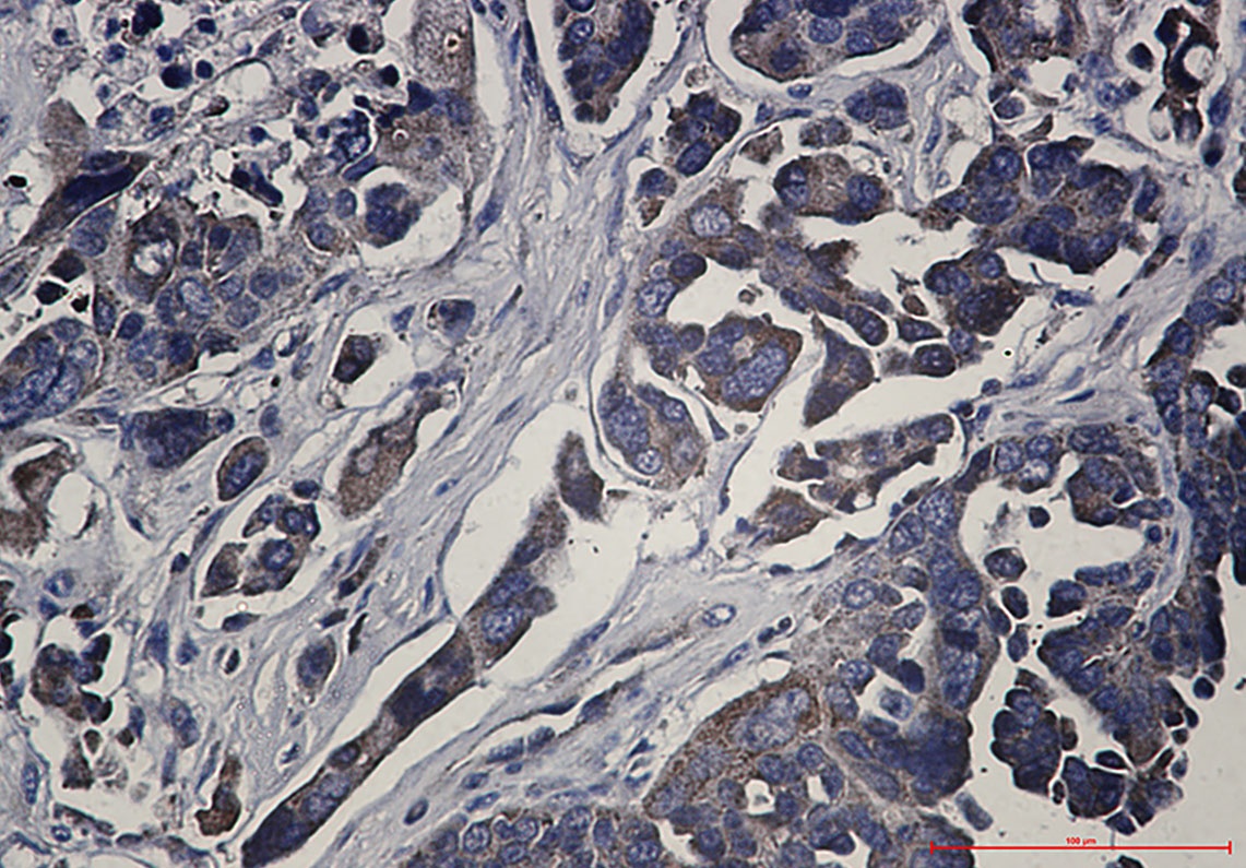 RPS6KA1 Antibody