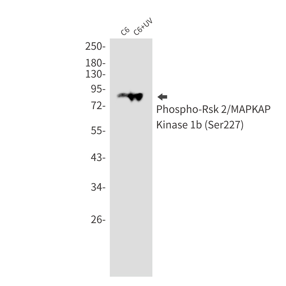 RPS6KA3 Antibody