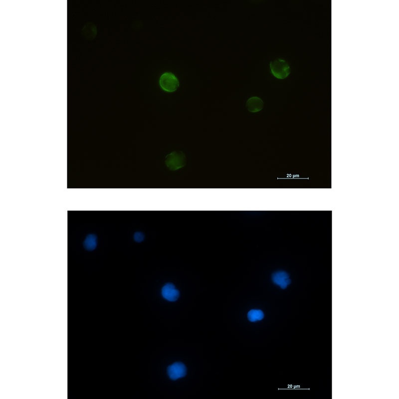 RRM2 Antibody