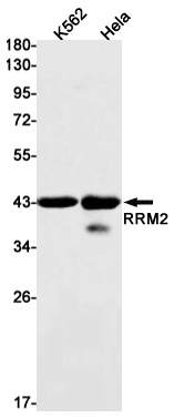 RRM2 Antibody