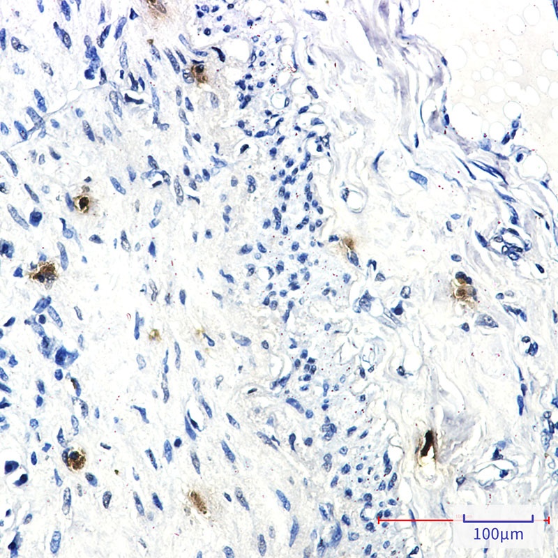 RRM1 Antibody