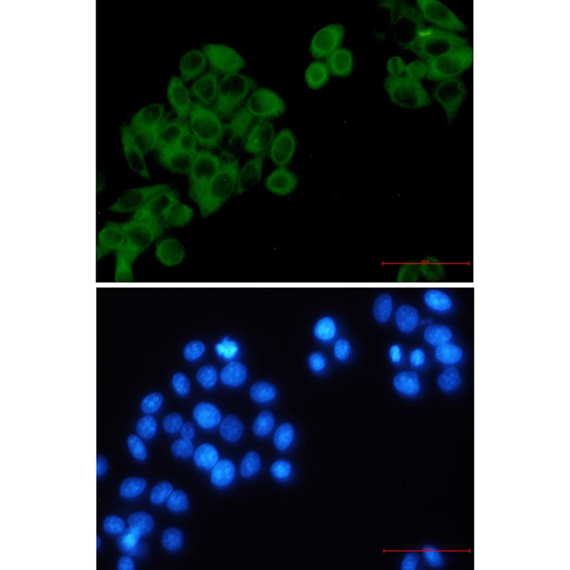 RRM1 Antibody