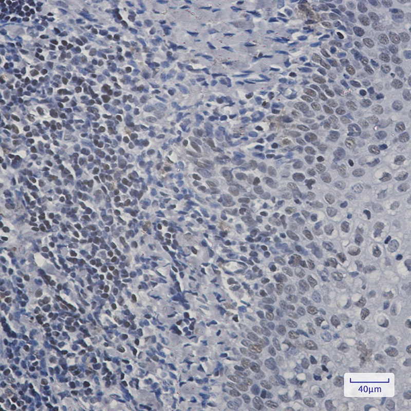 RPA32 Rabbit mAb
