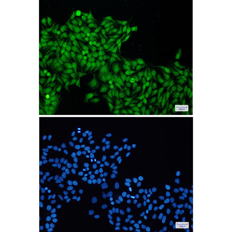 RBX1 Antibody