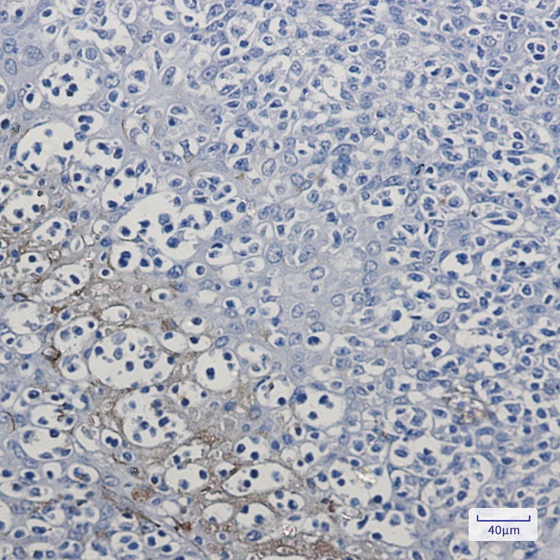 PEBP1 Antibody