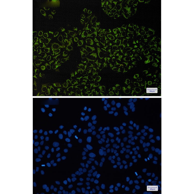 Complex III Subunit 5 Rabbit mAb