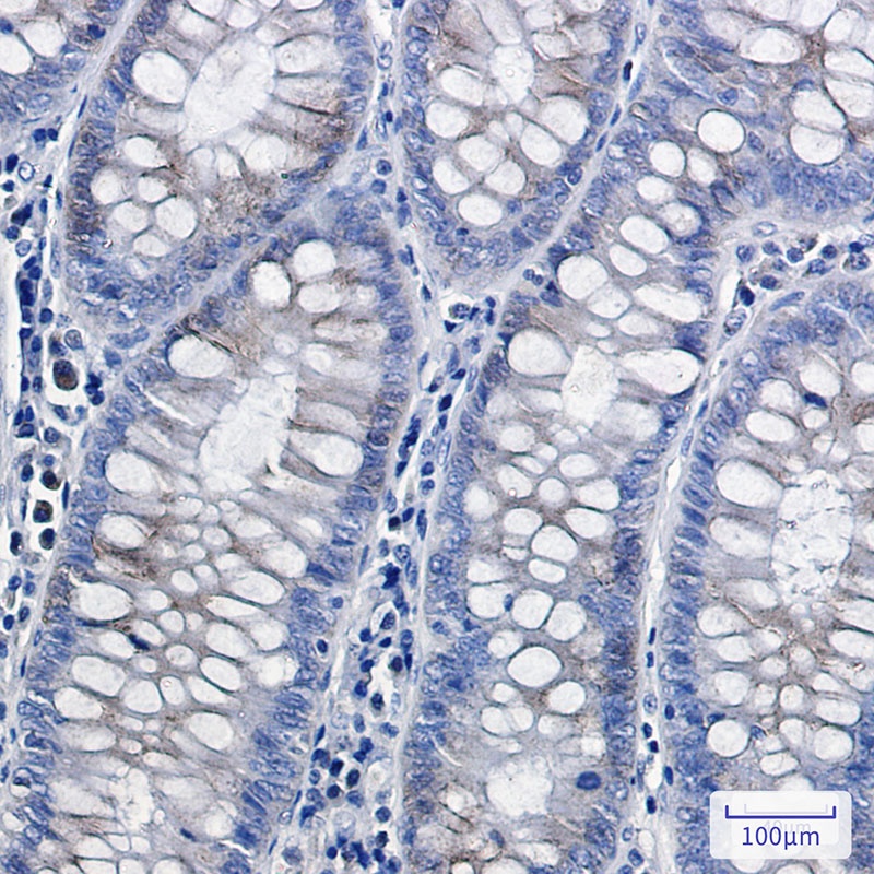 Complex III Subunit 5 Rabbit mAb