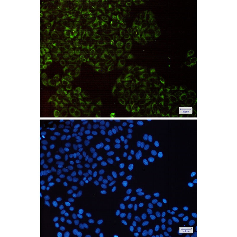 Complex III Subunit 5 Rabbit mAb