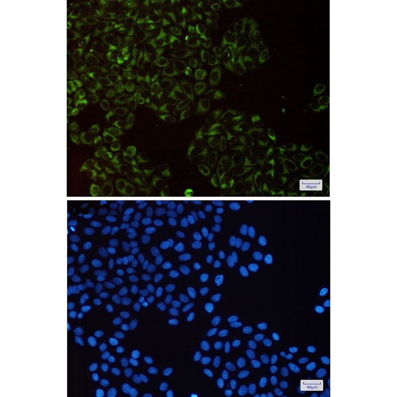 UQCRFS1 Antibody