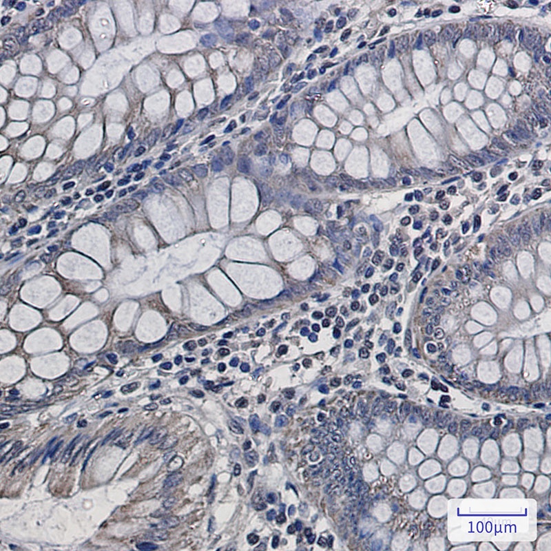 Complex III Subunit 5 Rabbit mAb