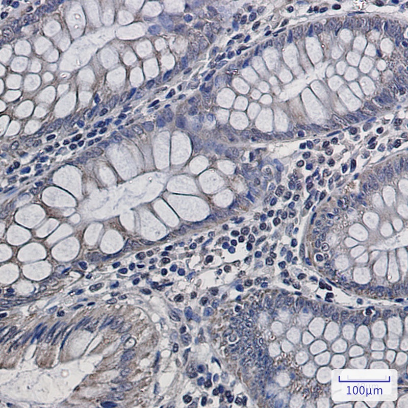 UQCRFS1 Antibody