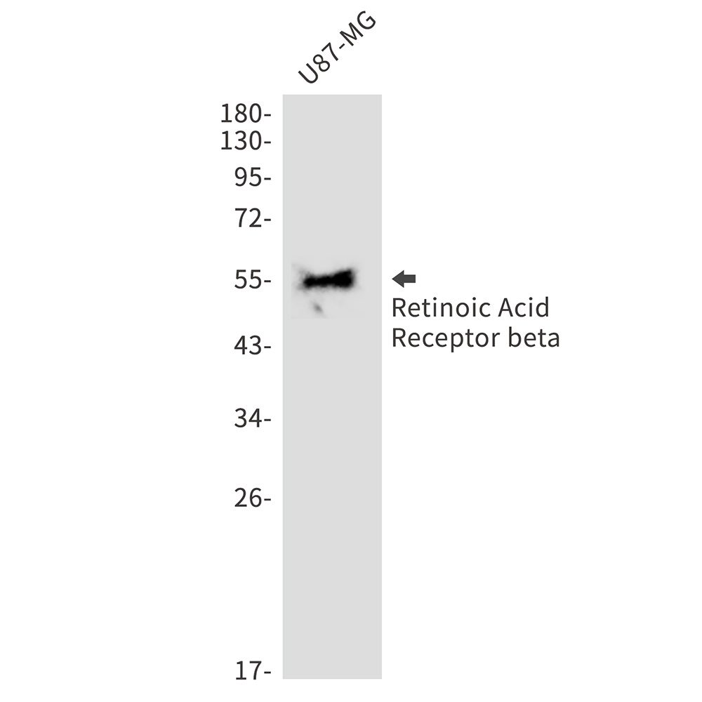 Retinoic Acid Receptor beta Rabbit mAb