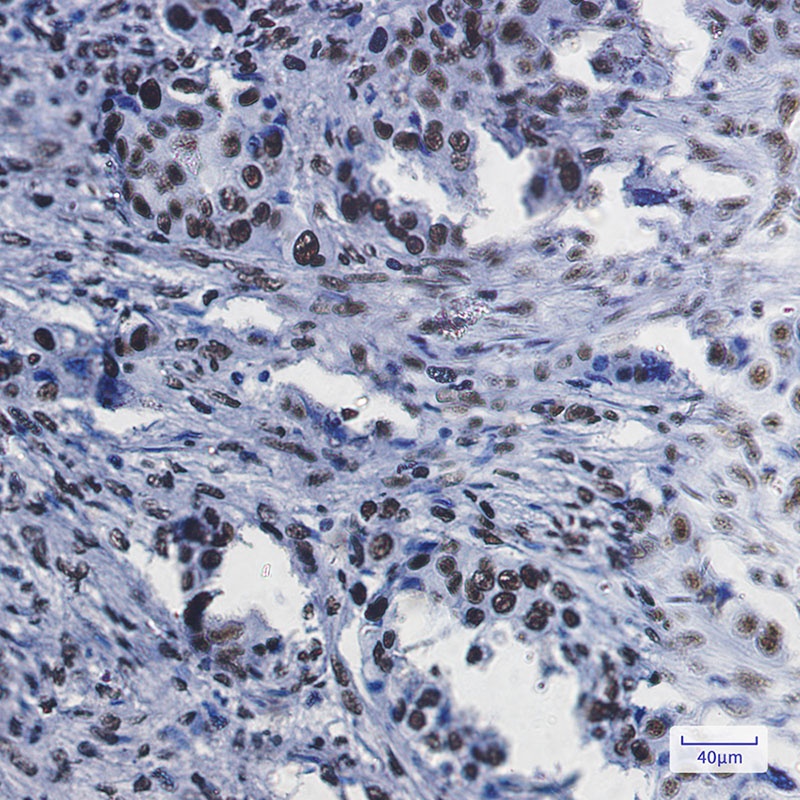 RBBP4 Rabbit mAb