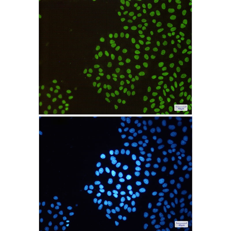 RBBP4 Rabbit mAb