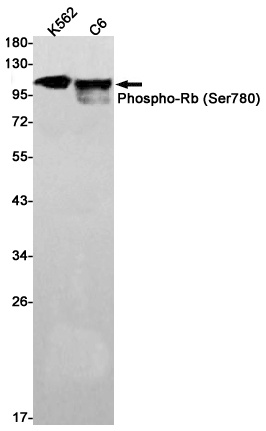 RB1 Antibody