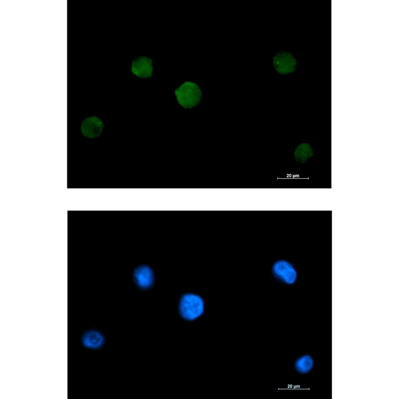 RAVER2 Rabbit mAb