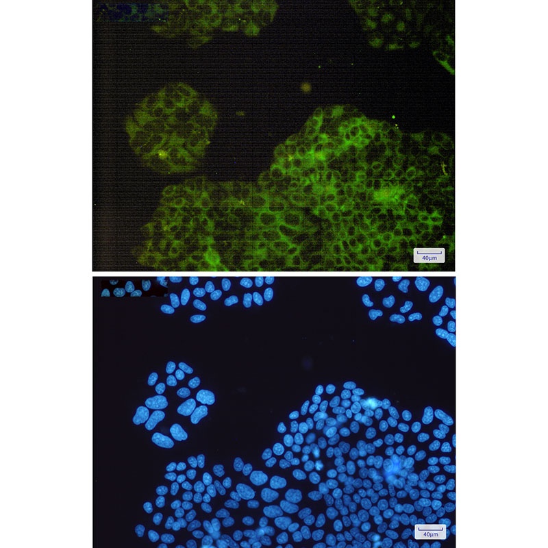 RAP1GAP Antibody