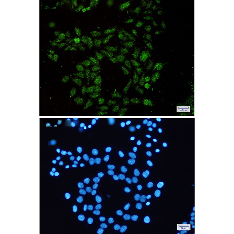 RAP1GAP Antibody