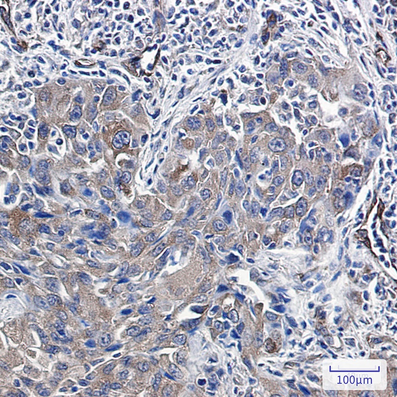 Radixin Rabbit mAb