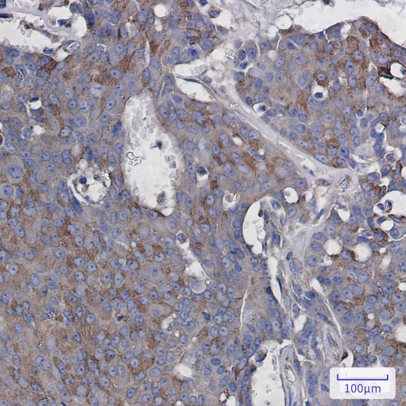 Rac3 Rabbit mAb