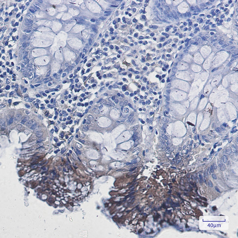 RAB9A Antibody