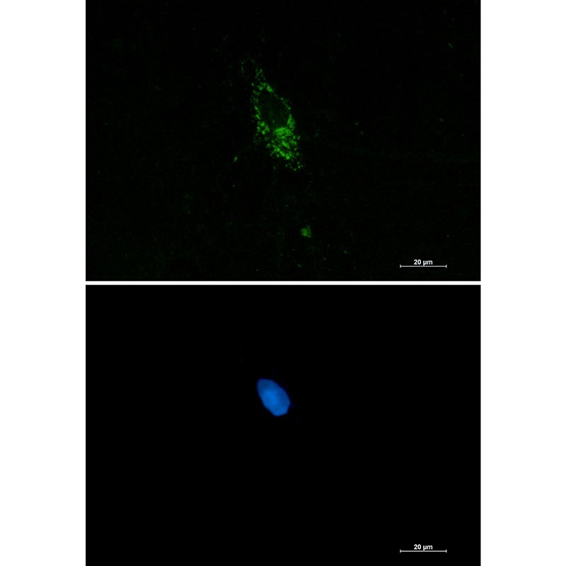 PUM1 Antibody