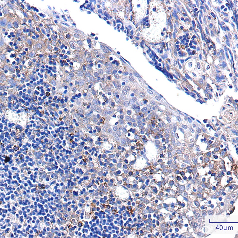 PUM1 Antibody