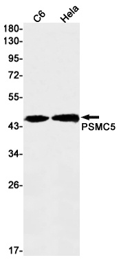 PSMC5 Rabbit mAb