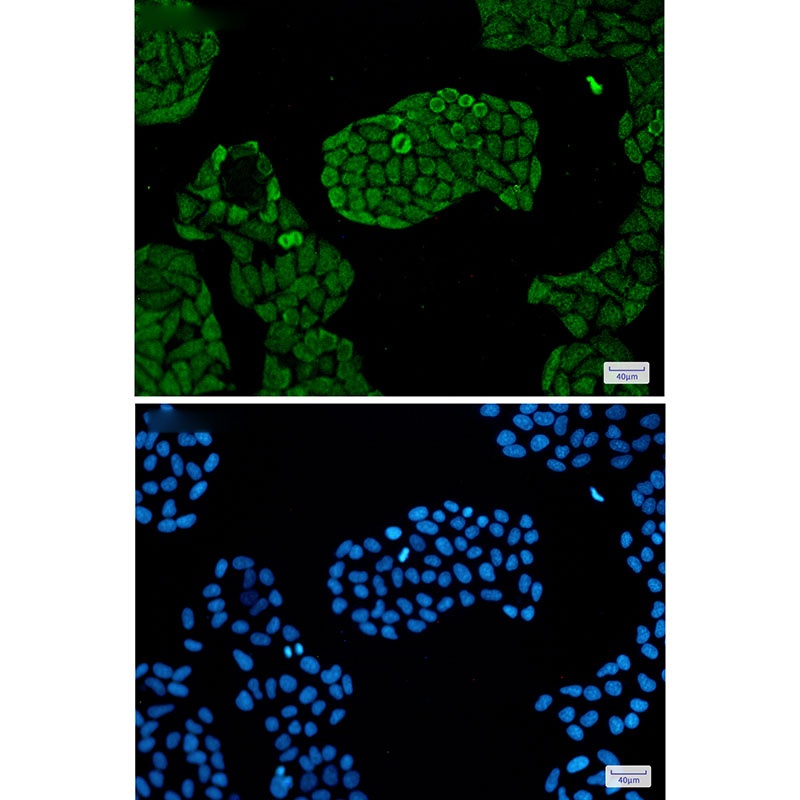 PSMC5 Rabbit mAb