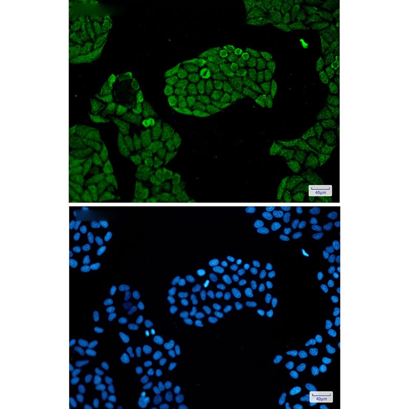 PSMC5 Antibody