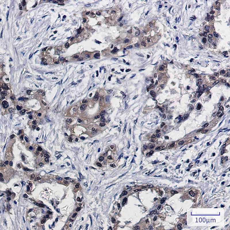 PSMB10 Antibody