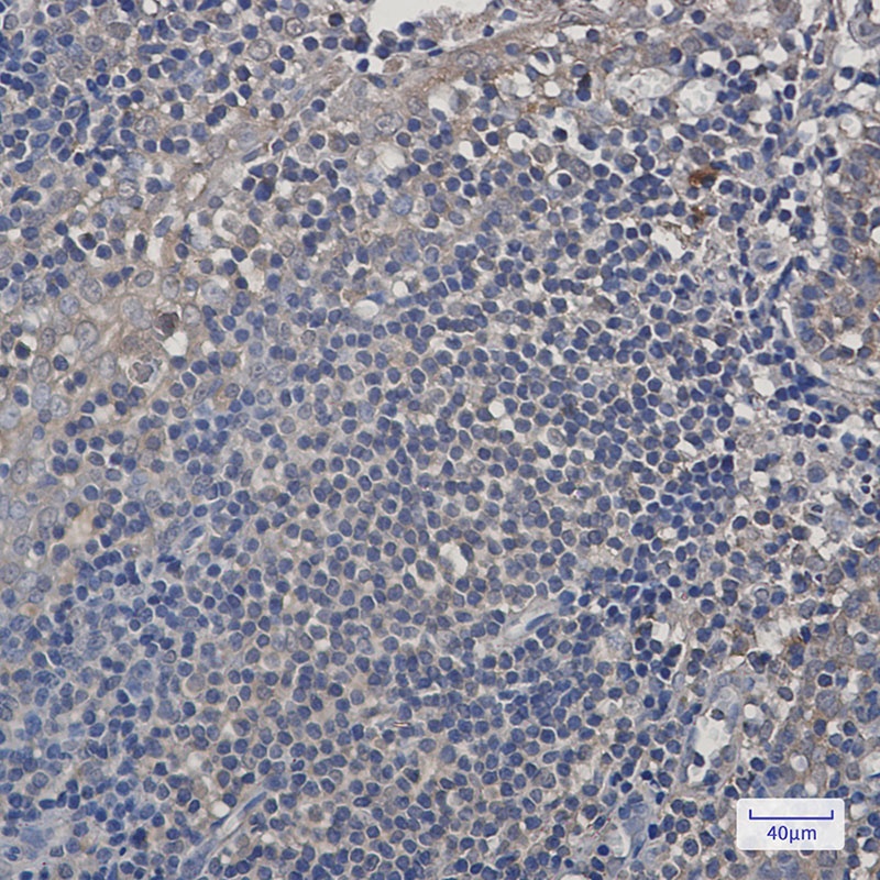 PSMA4 Rabbit mAb