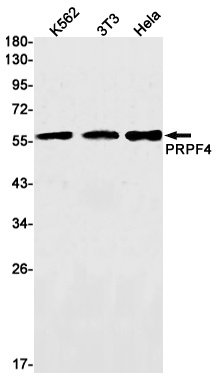 PRPF4 Rabbit mAb