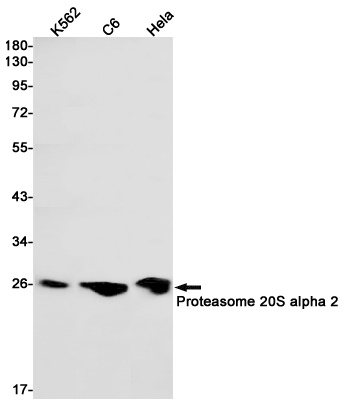 Proteasome alpha 2 Rabbit mAb