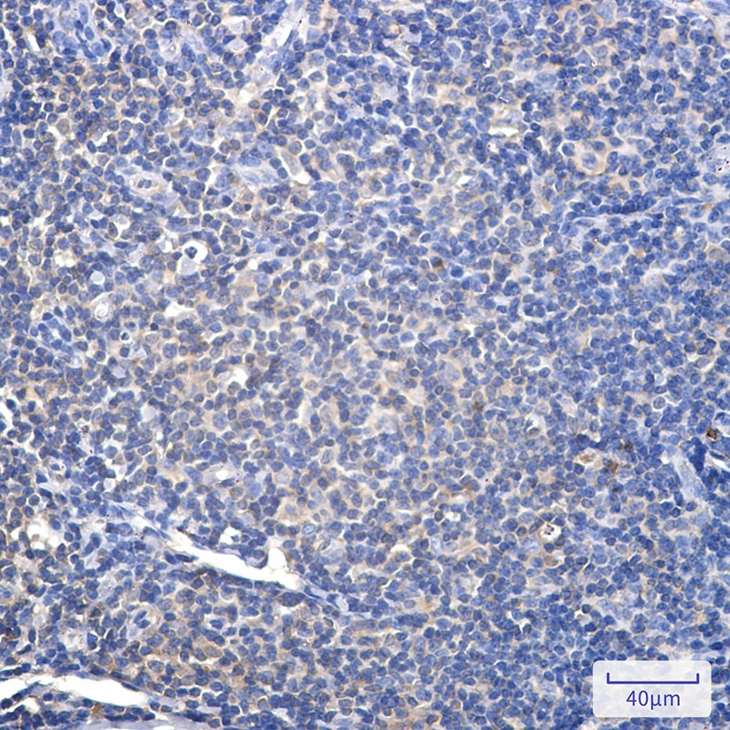 Proteasome alpha 2 Rabbit mAb