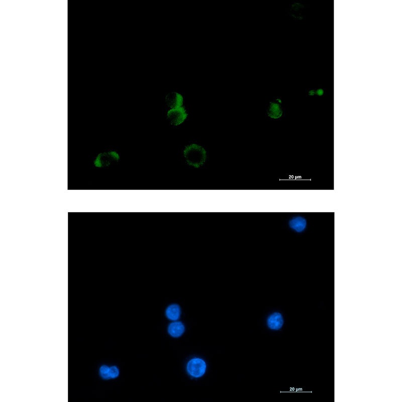 PTGDS Antibody