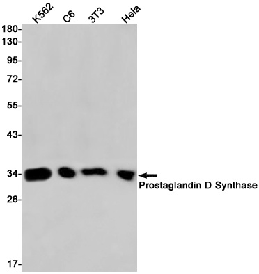 PTGDS Antibody