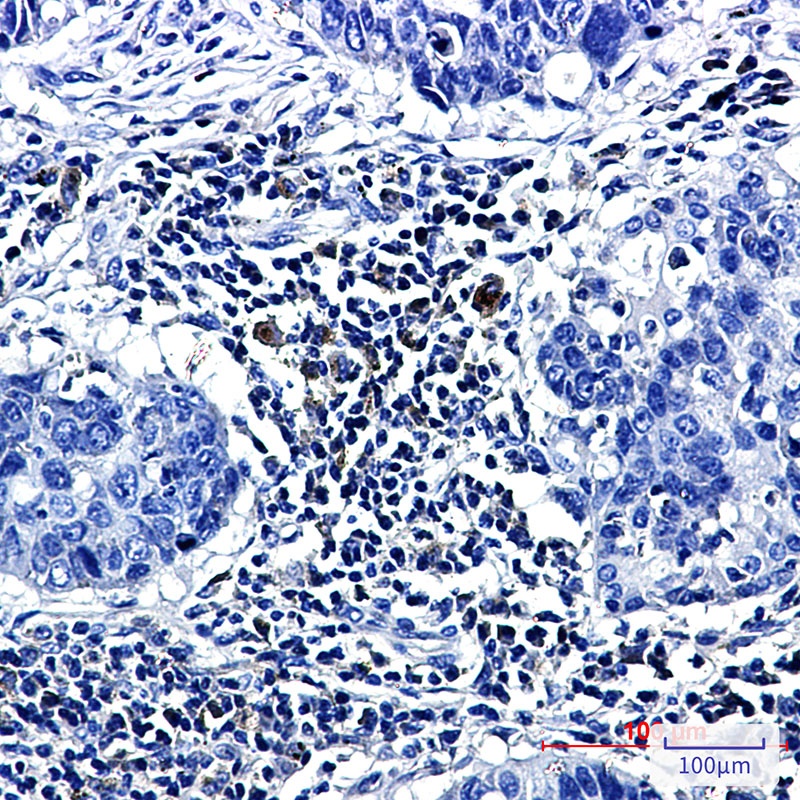 PTGDS Antibody