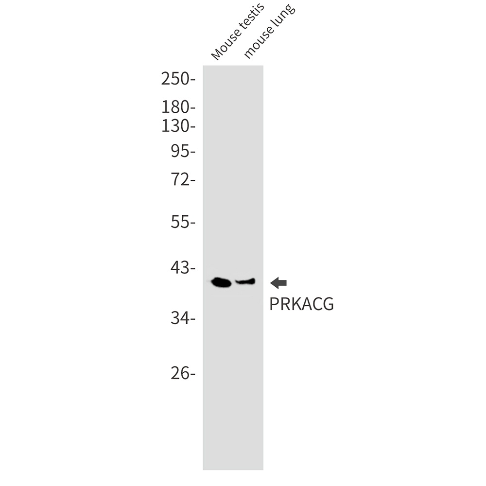 PRKACG Rabbit Monoclonal Antibody
