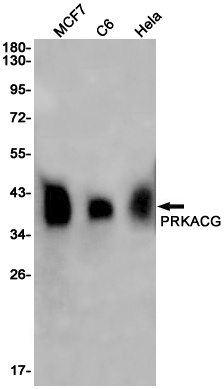 PRKACG Rabbit Monoclonal Antibody