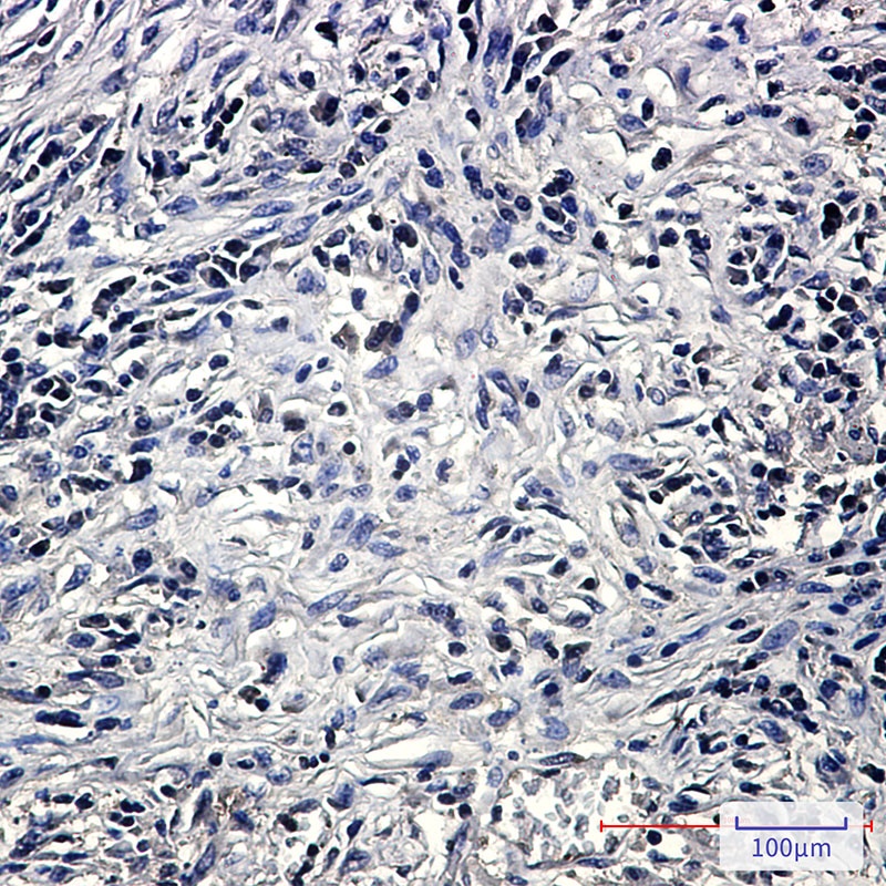 PP2A alpha/beta Rabbit mAb