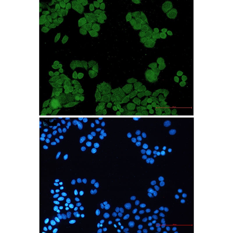 PP2A alpha/beta Rabbit mAb