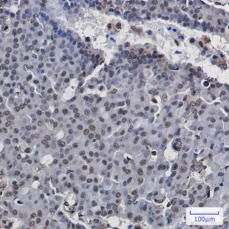 RNA Polymerases I/II/III Subunit ABC1 Rabbit mAb