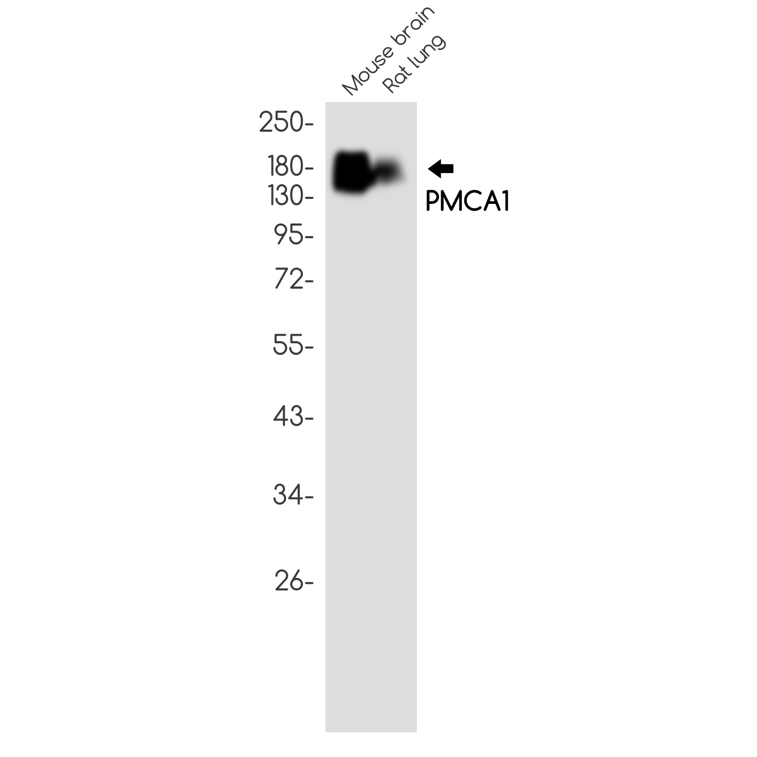 PMCA1 Rabbit mAb