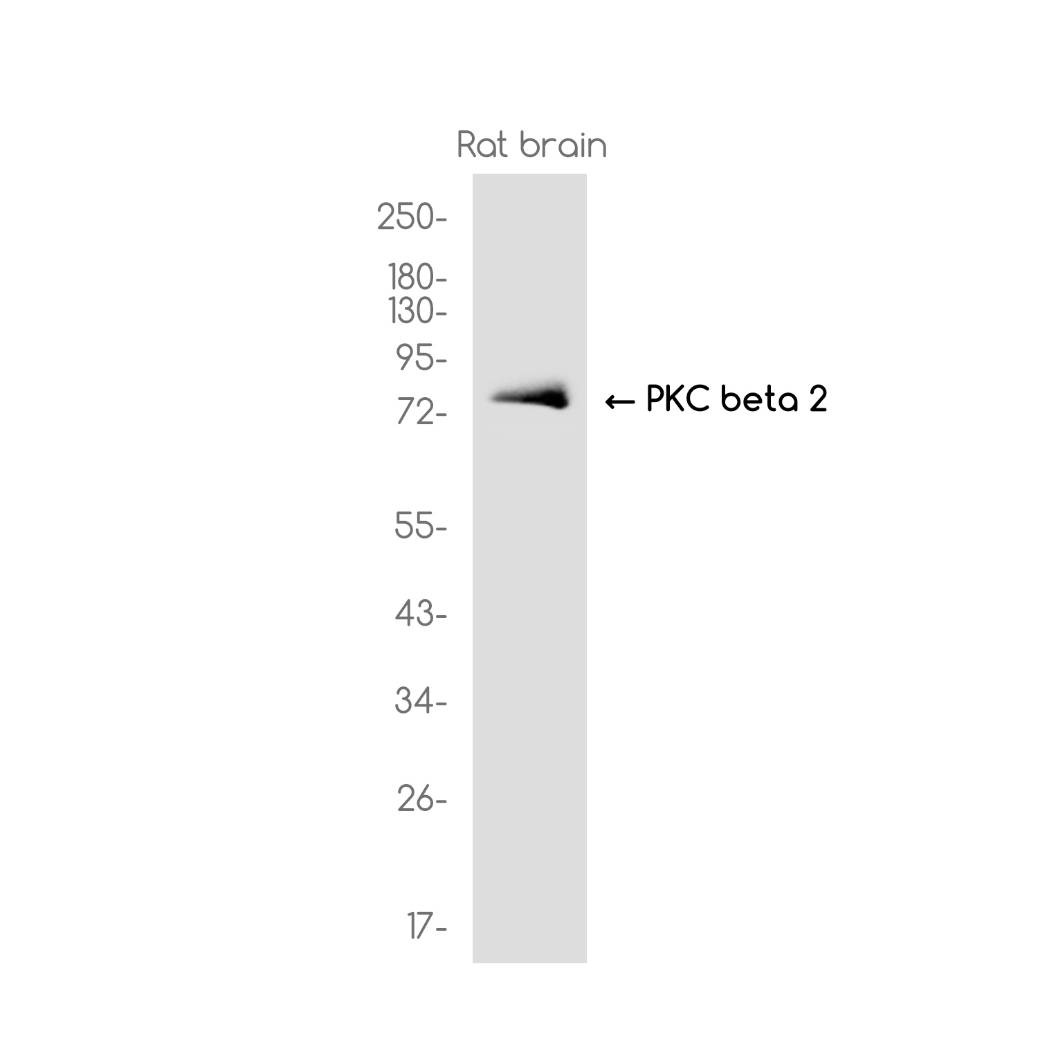PKC beta 2 Rabbit mAb