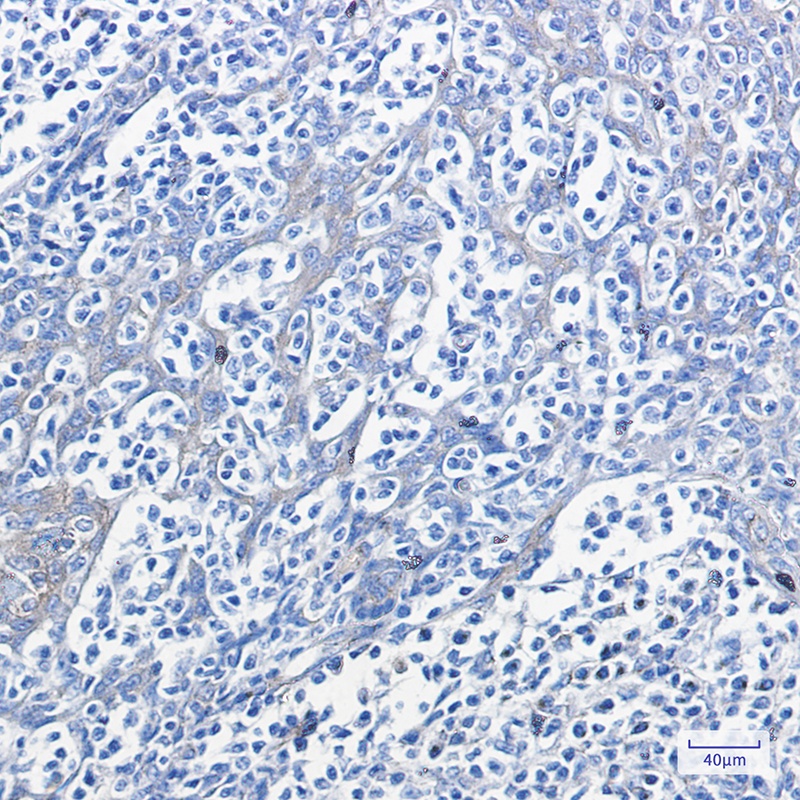 PRKAR2A Antibody