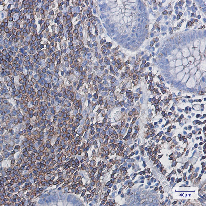 PHD3 Rabbit mAb
