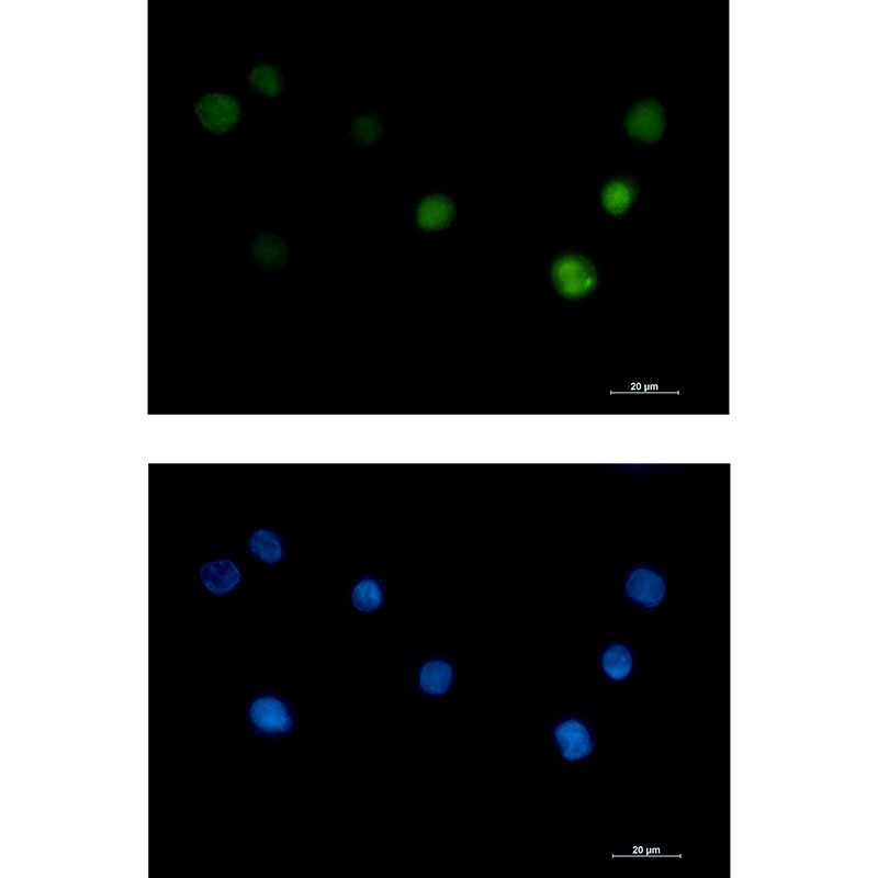 ANP32B Antibody